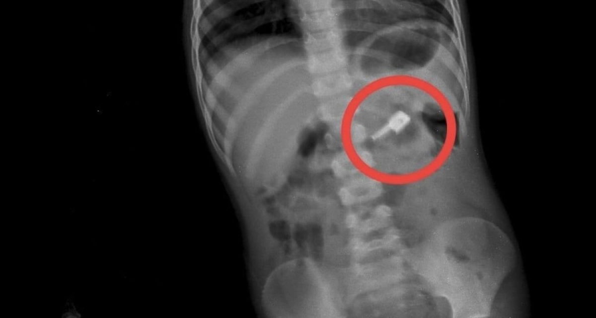 Фото: пресс-служба Жамбыслкой многопрофильной областной больницы