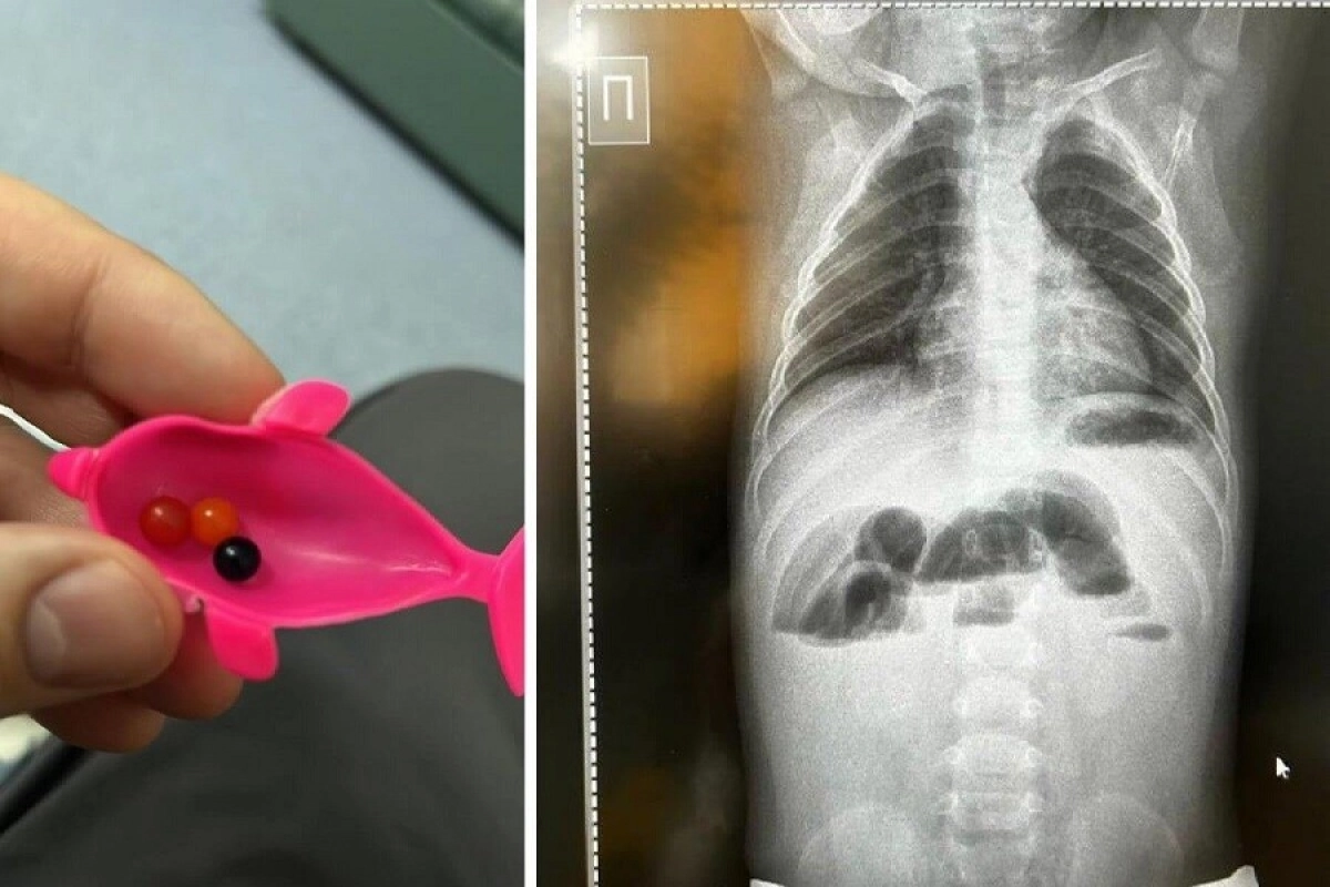 Фото: пресс-служба МГДБ №2