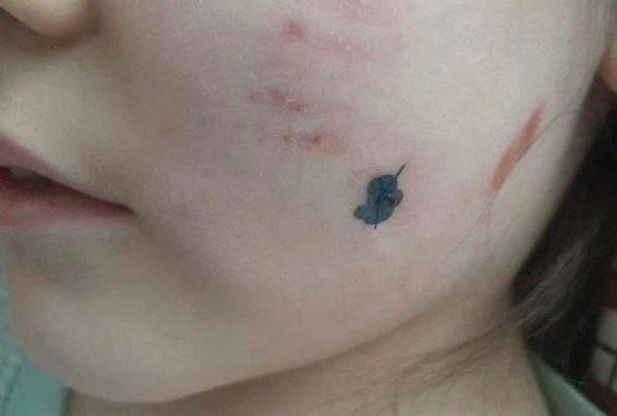 Фото: Телеграм-канал Abainewskz.