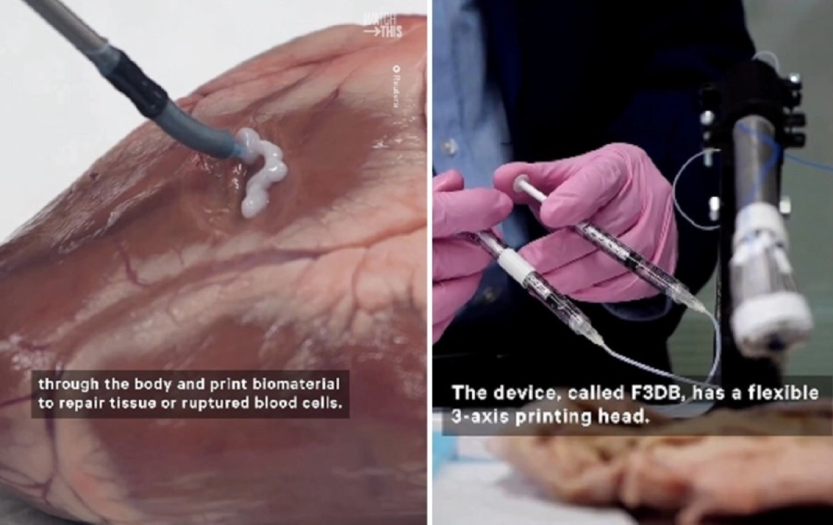 Кадр из видео