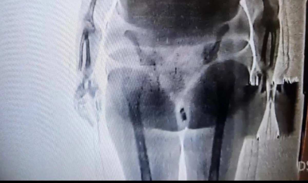 Фото: polisia.kz