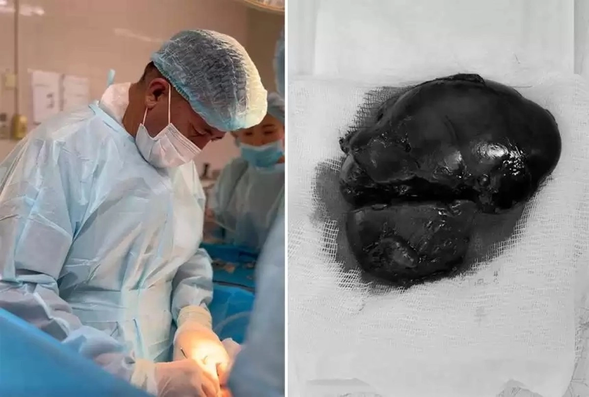 Фото: управление здравоохранения Алматинской области