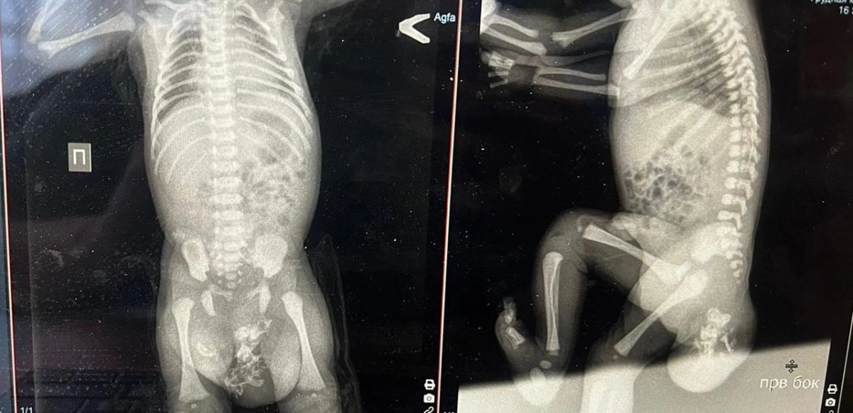 Фото: УОЗ Алматы