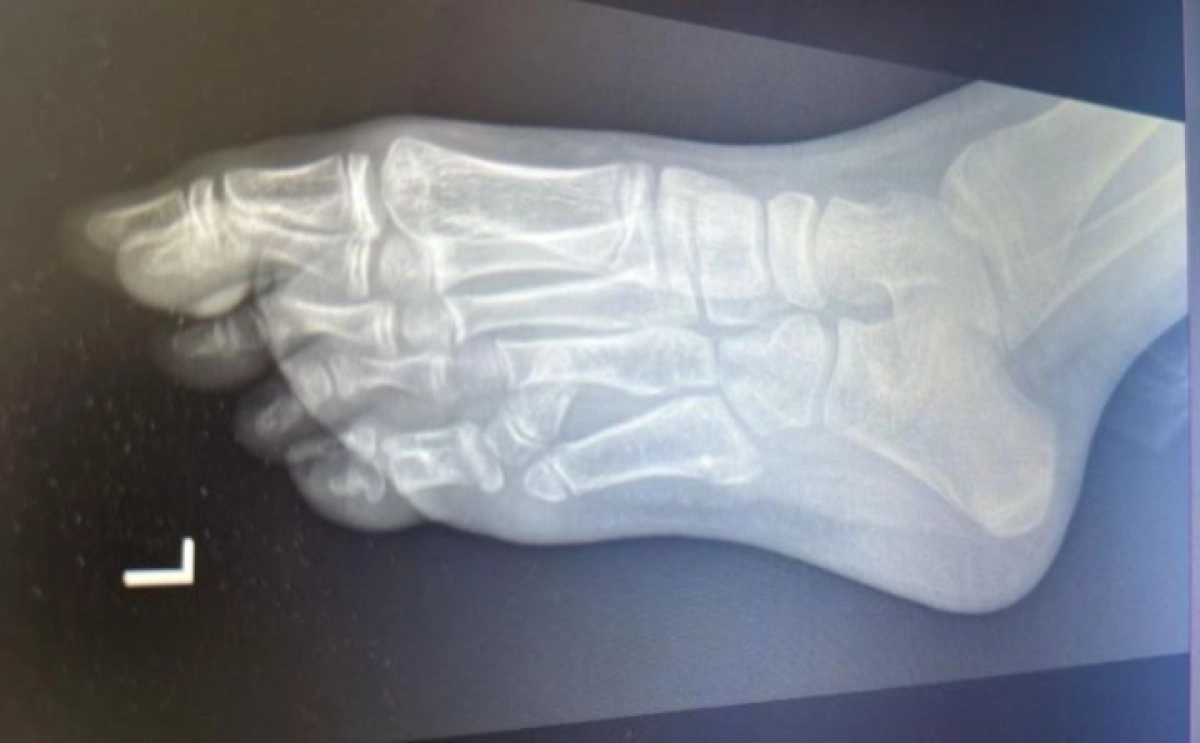 Фото: УОЗ Алматы