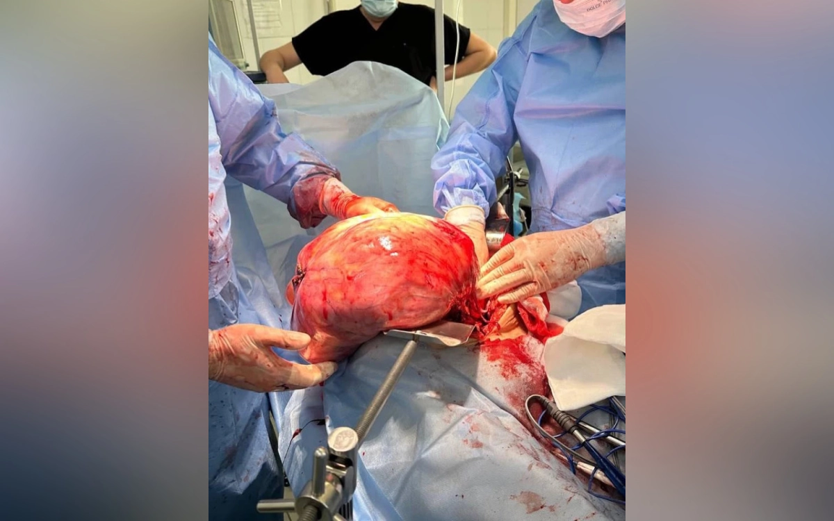 Фото: Управление здравоохранения ЗКО