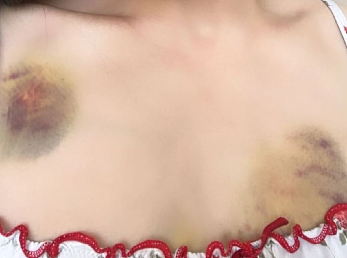 Фото: Iinstagram/azamat_sarsenbayev