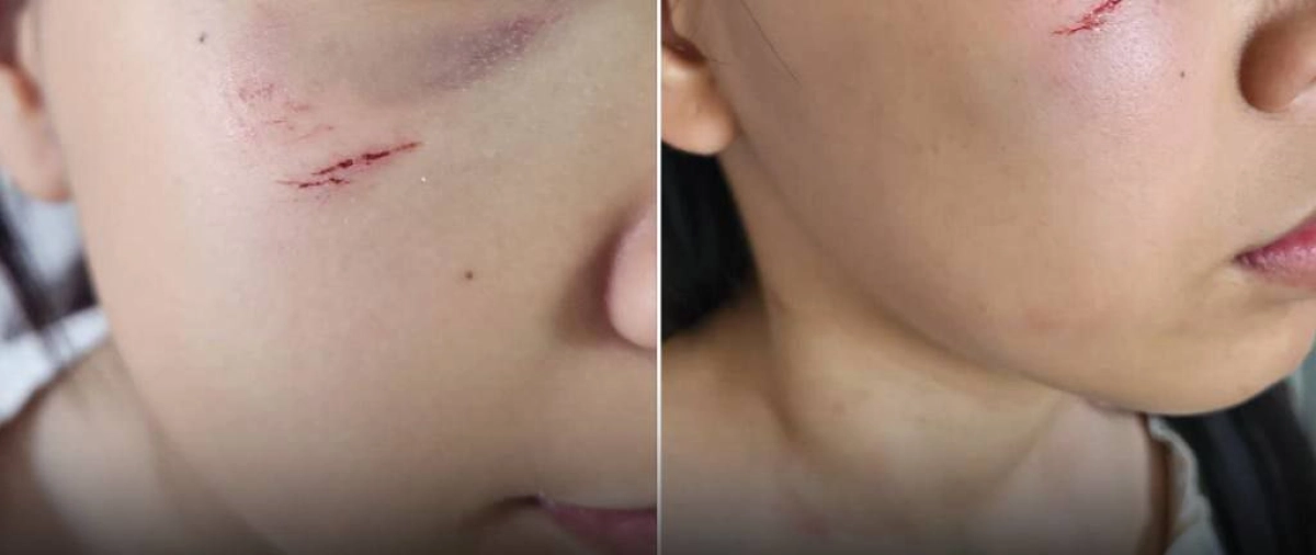 Фото: "НеМолчи"