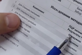 Врач из Астаны показал пациента с хламидиозом после незащищённого секса