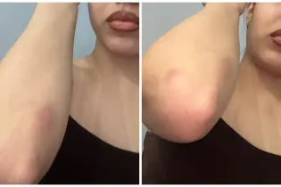 Хореограф из Астаны обвинила известного танцора в рукоприкладстве